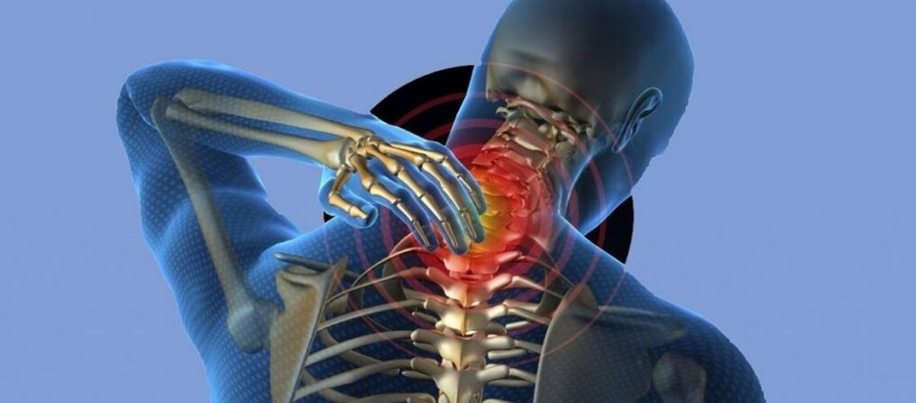 Osteocondrose da columna cervical