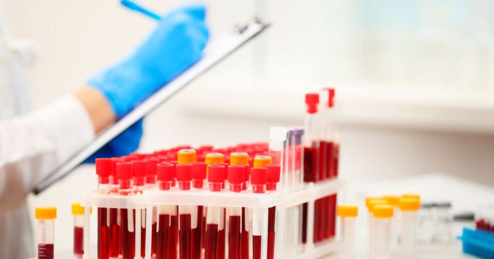 Realizar unha proba de sangue para detectar a inflamación