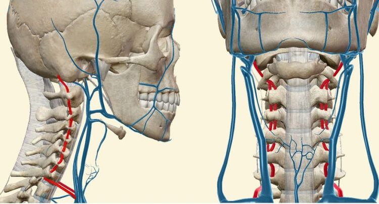 Síndrome vascular en osteocondrose